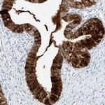 Mammaglobin B Antibody in Immunohistochemistry (IHC)