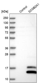 Mammaglobin B Antibody in Western Blot (WB)