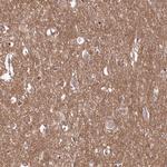C10orf35 Antibody in Immunohistochemistry (IHC)