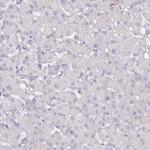 C10orf35 Antibody in Immunohistochemistry (IHC)