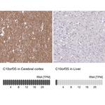 C10orf35 Antibody