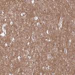 C10orf35 Polyclonal Antibody