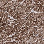 NDUFB3 Polyclonal Antibody