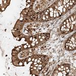 CCDC115 Polyclonal Antibody