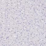 FATE1 Antibody in Immunohistochemistry (Paraffin) (IHC (P))