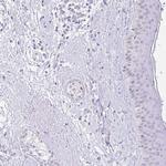 FATE1 Polyclonal Antibody