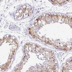 FATE1 Antibody in Immunohistochemistry (IHC)