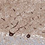 NEDL2 Antibody in Immunohistochemistry (IHC)