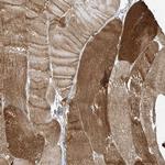 ZNF846 Polyclonal Antibody