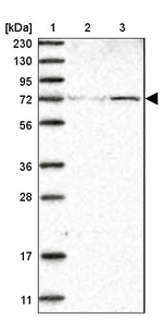 ZNF846 Antibody in Western Blot (WB)
