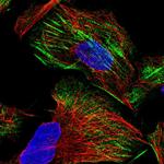 ZNF846 Polyclonal Antibody