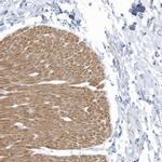 ZNF846 Antibody in Immunohistochemistry (Paraffin) (IHC (P))