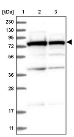 SRP72 Antibody in Western Blot (WB)