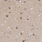 GNB1L Antibody in Immunohistochemistry (Paraffin) (IHC (P))