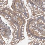 GNB1L Antibody in Immunohistochemistry (Paraffin) (IHC (P))