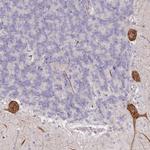 NCKAP5 Antibody in Immunohistochemistry (Paraffin) (IHC (P))