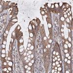 RIN2 Antibody in Immunohistochemistry (IHC)
