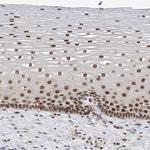 APLF Antibody in Immunohistochemistry (Paraffin) (IHC (P))