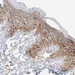 C2orf18 Polyclonal Antibody