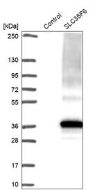 C2orf18 Antibody in Western Blot (WB)