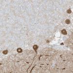 C11orf87 Polyclonal Antibody