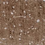 C11orf87 Antibody in Immunohistochemistry (Paraffin) (IHC (P))