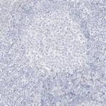 C11orf87 Antibody in Immunohistochemistry (Paraffin) (IHC (P))