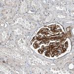 TENC1 Antibody in Immunohistochemistry (Paraffin) (IHC (P))
