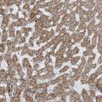 TENC1 Antibody in Immunohistochemistry (Paraffin) (IHC (P))