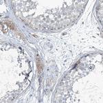 TENC1 Antibody in Immunohistochemistry (Paraffin) (IHC (P))