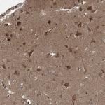 CSN7b Antibody in Immunohistochemistry (Paraffin) (IHC (P))