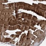 CSN7b Antibody in Immunohistochemistry (Paraffin) (IHC (P))