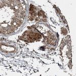 CSN7b Antibody in Immunohistochemistry (Paraffin) (IHC (P))