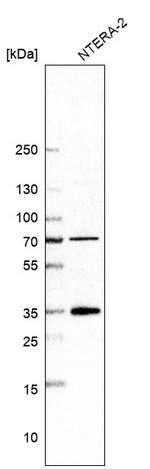 CSN7b Antibody in Western Blot (WB)