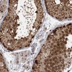 CSN7b Antibody in Immunohistochemistry (Paraffin) (IHC (P))