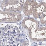 UGP2 Antibody in Immunohistochemistry (IHC)