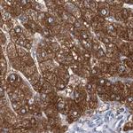 UGP2 Antibody in Immunohistochemistry (IHC)