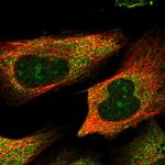 TSPYL6 Polyclonal Antibody