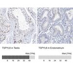 TSPYL6 Antibody in Immunohistochemistry (IHC)