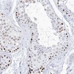 TSPYL6 Antibody in Immunohistochemistry (IHC)