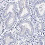 TSPYL6 Antibody in Immunohistochemistry (IHC)