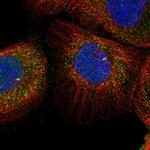 TSPYL6 Polyclonal Antibody