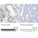 TSPYL6 Antibody in Immunohistochemistry (IHC)