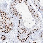 TSPYL6 Antibody in Immunohistochemistry (IHC)