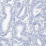 TSPYL6 Antibody in Immunohistochemistry (IHC)