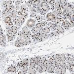 HEMK1 Antibody in Immunohistochemistry (Paraffin) (IHC (P))