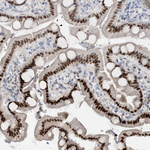 HEMK1 Antibody in Immunohistochemistry (Paraffin) (IHC (P))