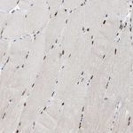 HEMK1 Antibody in Immunohistochemistry (Paraffin) (IHC (P))