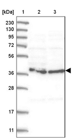 HEMK1 Antibody in Western Blot (WB)