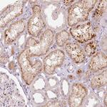 FAM82A1 Polyclonal Antibody